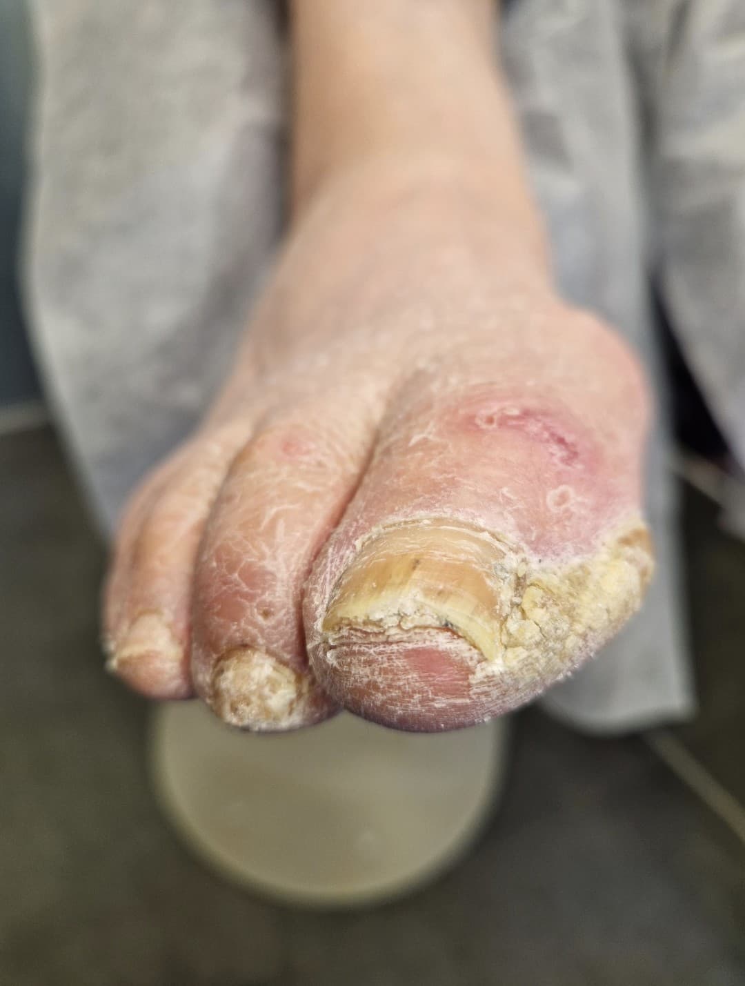 Pedicure dla seniora 70+
